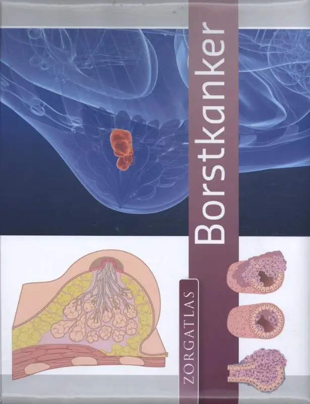 Borstkanker