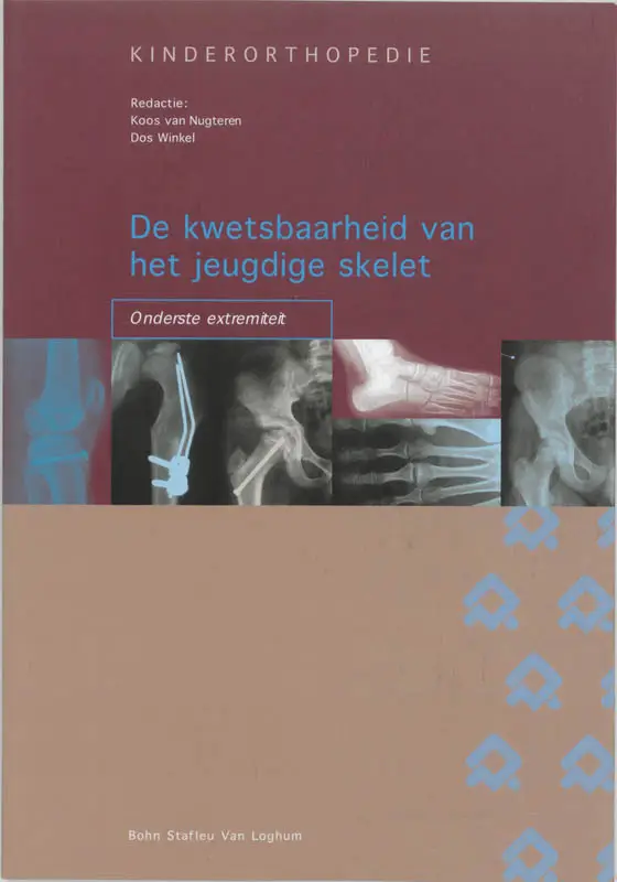 De kwetsbaarheid van het jeugdige skelet: onderste extremiteit
