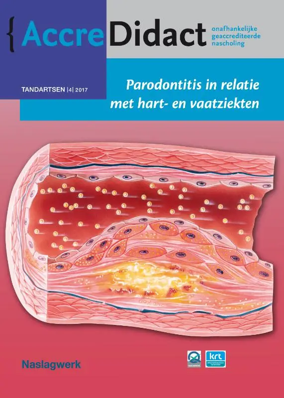 Parodontitis in relatie met hart- en vaatziekten